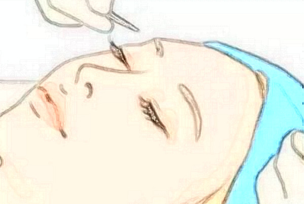 重医附二院整形科